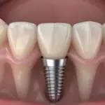 639026071152295431